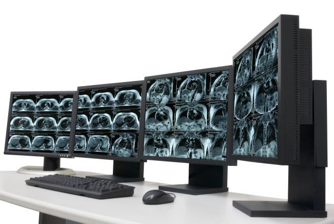 Imaging Scans