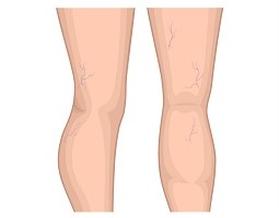 Reticular Veins